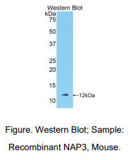 https://msimg.bioon.com/bionline/goods-no-pic.png