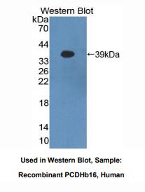 人原钙黏素β16(PCDHb16)多克隆抗体
