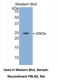 大鼠衰老关键蛋白2(FBLN2)多克隆抗体