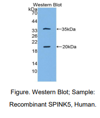 人丝氨酸肽酶抑制因子Kazal型5(SPINK5)多克隆抗体
