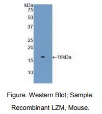 https://msimg.bioon.com/bionline/goods-no-pic.png