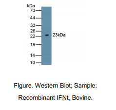 https://msimg.bioon.com/bionline/goods-no-pic.png