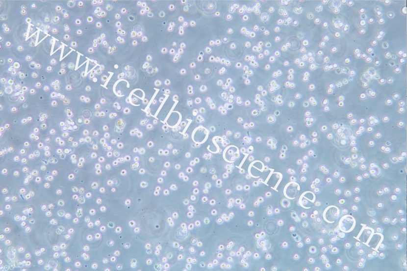 AKATA细胞/AKATA细胞/AKATA细胞/EBV转化淋巴细胞系