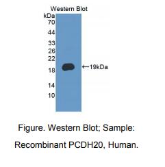 https://msimg.bioon.com/bionline/goods-no-pic.png