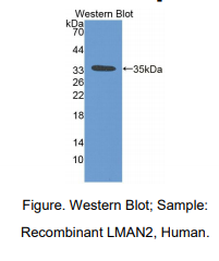 https://msimg.bioon.com/bionline/goods-no-pic.png