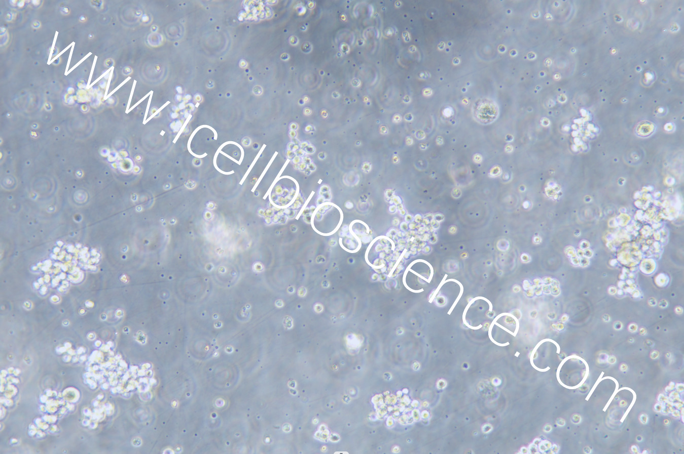 SU-DHL-2细胞/SUDHL-2细胞/SU-DHL2细胞/SUDHL2细胞/SUDHL-2/SUDHL2/人B细胞淋巴瘤细胞