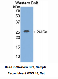 https://msimg.bioon.com/bionline/goods-no-pic.png