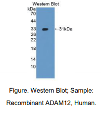 人解整合素金属蛋白酶12(ADAM12)多克隆抗体