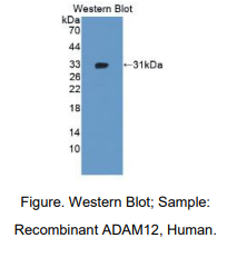 https://msimg.bioon.com/bionline/goods-no-pic.png