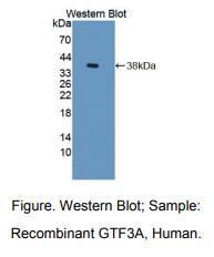 https://msimg.bioon.com/bionline/goods-no-pic.png