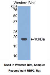 大鼠视黄醇结合蛋白2(RBP2)多克隆抗体