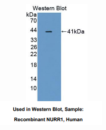 https://msimg.bioon.com/bionline/goods-no-pic.png