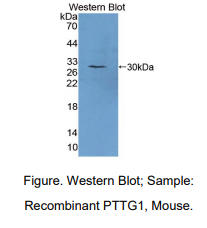 https://msimg.bioon.com/bionline/goods-no-pic.png