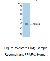 人过氧化物酶体增殖物激活受体γ(PPARg)多克隆抗体