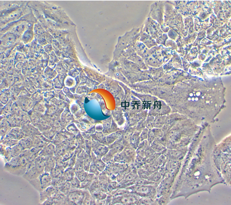 人乳腺腺癌细胞