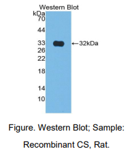 https://msimg.bioon.com/bionline/goods-no-pic.png