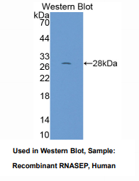 https://msimg.bioon.com/bionline/goods-no-pic.png