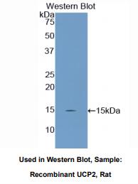 https://msimg.bioon.com/bionline/goods-no-pic.png