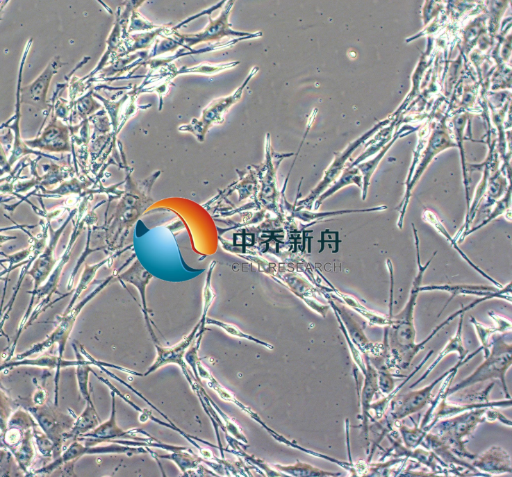 https://img.medsci.cn/8eee53bbc4cb7a98de615e72115896bc4e27fda5cbb764dbd67d9d641c2bb46a.png