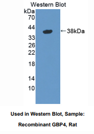 大鼠鸟苷酸结合蛋白4(GBP4)多克隆抗体