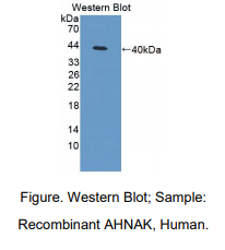 人桥粒联结蛋白(AHNAK)多克隆抗体