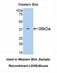 https://msimg.bioon.com/bionline/goods-no-pic.png