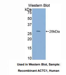 https://msimg.bioon.com/bionline/goods-no-pic.png