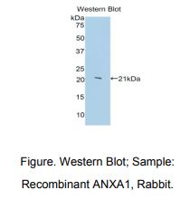 兔膜联蛋白A1(ANXA1)多克隆抗体