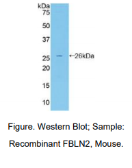 https://msimg.bioon.com/bionline/goods-no-pic.png