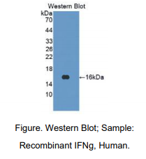 https://msimg.bioon.com/bionline/goods-no-pic.png