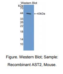 https://msimg.bioon.com/bionline/goods-no-pic.png