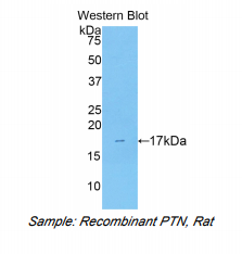 https://msimg.bioon.com/bionline/goods-no-pic.png