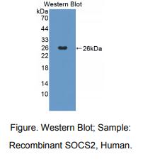 人细胞因子信号转导抑制因子2(SOCS2)多克隆抗体