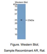 大鼠雄激素受体(AR)多克隆抗体