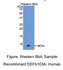 https://msimg.bioon.com/bionline/goods-no-pic.png