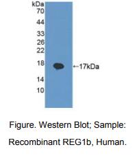 人再生胰岛衍生蛋白1β(REG1b)多克隆抗体
