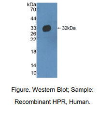 https://msimg.bioon.com/bionline/goods-no-pic.png