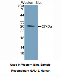 人半乳糖凝集素12(GAL12)多克隆抗体