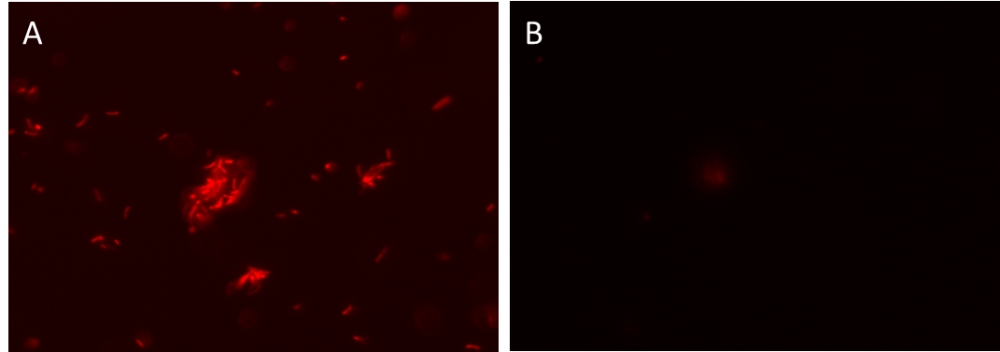 https://img.medsci.cn/e73eefcea40976357f460123cbf1e819c54e5106c9b457225be13b1cbc991aff.png