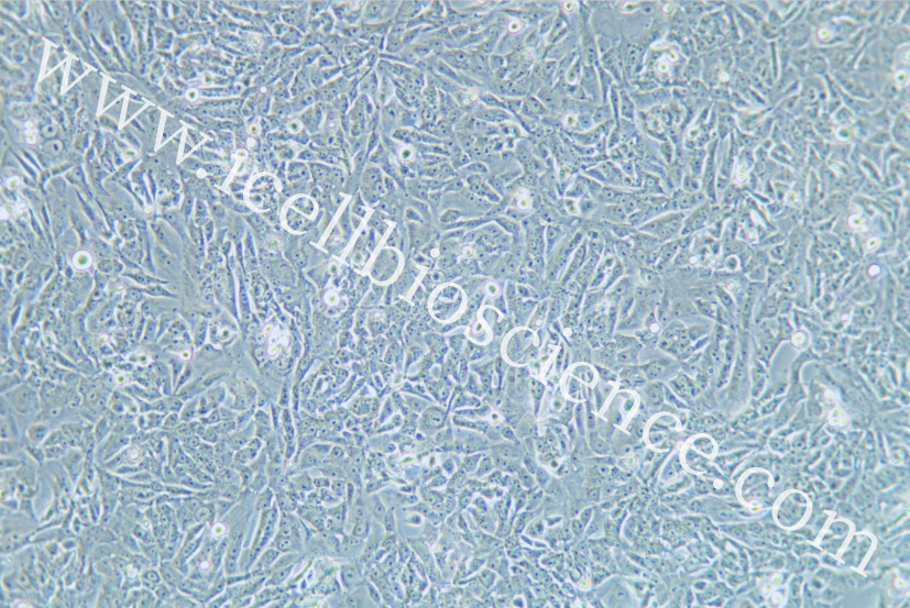 SK-N-AS细胞/SKN-AS细胞/SK-NAS细胞/SKNAS细胞/人脑神经母细胞瘤细胞