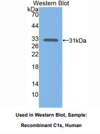 https://msimg.bioon.com/bionline/goods-no-pic.png