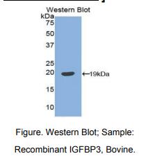 https://msimg.bioon.com/bionline/goods-no-pic.png