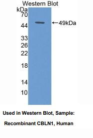 https://msimg.bioon.com/bionline/goods-no-pic.png