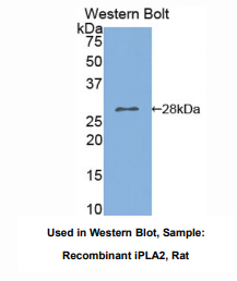 https://msimg.bioon.com/bionline/goods-no-pic.png