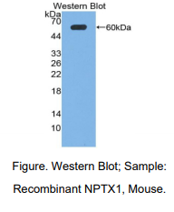 小鼠神经元正五聚蛋白Ⅰ(NPTX1)多克隆抗体