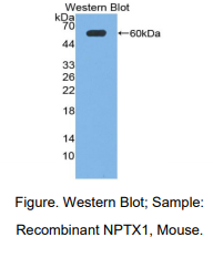 https://msimg.bioon.com/bionline/goods-no-pic.png