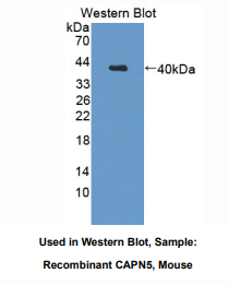 https://msimg.bioon.com/bionline/goods-no-pic.png