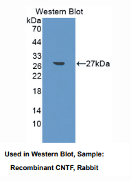 https://msimg.bioon.com/bionline/goods-no-pic.png