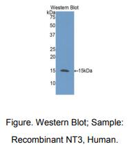 https://msimg.bioon.com/bionline/goods-no-pic.png