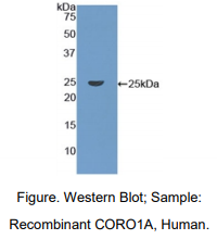 人冠蛋白1A(CORO1A)多克隆抗体